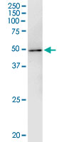5 - KIAA0261 Antibody (monoclonal) (M02) AT2612a