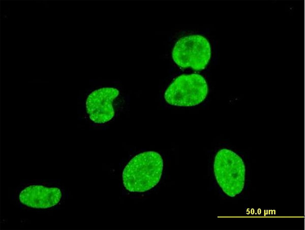 3 - KIAA0804 Antibody (monoclonal) (M01) AT2613a
