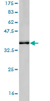 1 - KIAA0804 Antibody (monoclonal) (M01) AT2613a