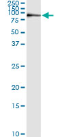 5 - KIF2C Antibody (monoclonal) (M01) AT2621a
