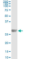 5 - KIRREL2 Antibody (monoclonal) (M01) AT2623a