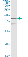 5 - KRT17 Antibody (monoclonal) (M01) AT2653a