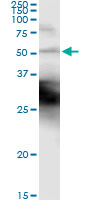 5 - KRT18 Antibody (monoclonal) (M01) AT2655a