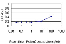 10 - KRTHA3B Antibody (monoclonal) (M01) AT2661a