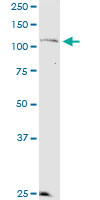 1 - KSR2 Antibody (monoclonal) (M08) AT2664a