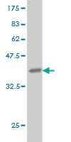 1 - LAMA5 Antibody (monoclonal) (M01) AT2669a