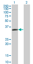 1 - LASP1 Antibody (monoclonal) (M05) AT2673a