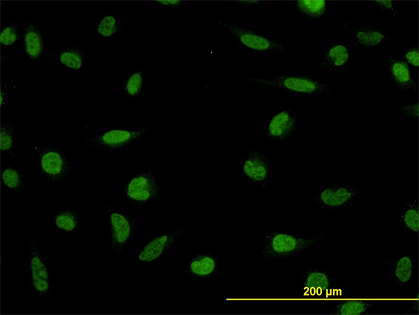 3 - LDB2 Antibody (monoclonal) (M01) AT2683a