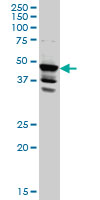 1 - LDB2 Antibody (monoclonal) (M01) AT2683a