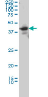 1 - LDB2 Antibody (monoclonal) (M02) AT2684a