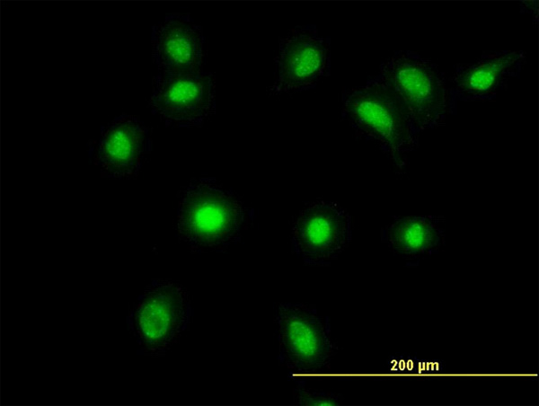 3 - LDB2 Antibody (monoclonal) (M03) AT2685a