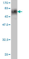 1 - LDB2 Antibody (monoclonal) (M03) AT2685a