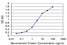 10 - LHX4 Antibody (monoclonal) (M04) AT2706a