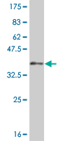 1 - LHX5 Antibody (monoclonal) (M05) AT2708a