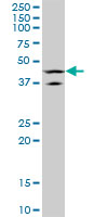 1 - LHX5 Antibody (monoclonal) (M05) AT2708a