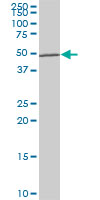1 - LHX5 Antibody (monoclonal) (M05) AT2708a