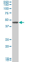 1 - LHX5 Antibody (monoclonal) (M05) AT2708a