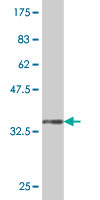 1 - LHX5 Antibody (monoclonal) (M10) AT2709a