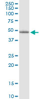 1 - LHX5 Antibody (monoclonal) (M10) AT2709a