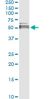 5 - LIPA Antibody (monoclonal) (M01) AT2718a
