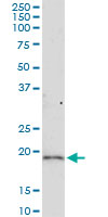 5 - LOC51255 Antibody (monoclonal) (M01) AT2734a