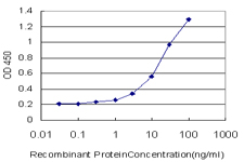 10 - LRAT Antibody (monoclonal) (M01) AT2737a