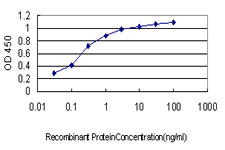 10 - LTBP2 Antibody (monoclonal) (M01) AT2747a