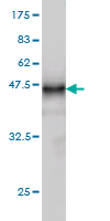 1 - LTBP2 Antibody (monoclonal) (M01) AT2747a