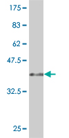 1 - LYPLA3 Antibody (monoclonal) (M01) AT2755a