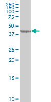 1 - LYPLA3 Antibody (monoclonal) (M01) AT2755a