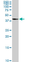 1 - LYPLA3 Antibody (monoclonal) (M01) AT2755a