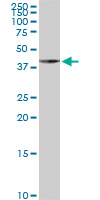 1 - LYPLA3 Antibody (monoclonal) (M01) AT2755a