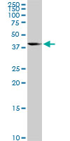 1 - LYPLA3 Antibody (monoclonal) (M01) AT2755a