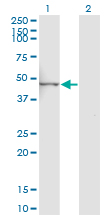 1 - LYPLA3 Antibody (monoclonal) (M01) AT2755a