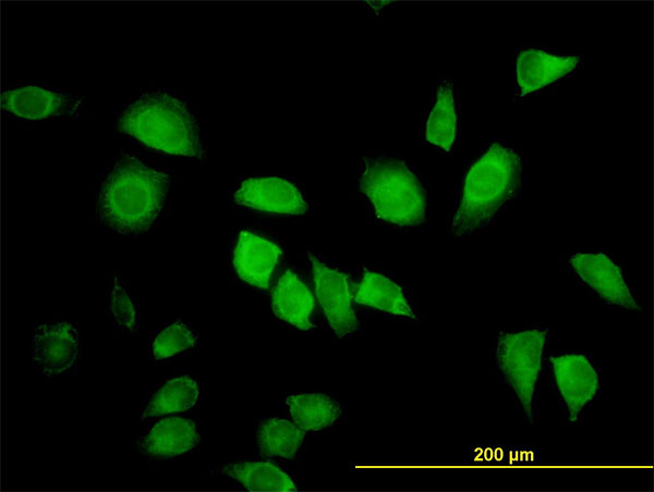 3 - LZTFL1 Antibody (monoclonal) (M01) AT2756a