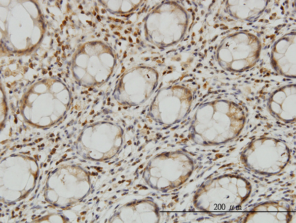 2 - LZTFL1 Antibody (monoclonal) (M01) AT2756a