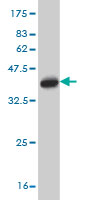 1 - LZTFL1 Antibody (monoclonal) (M01) AT2756a