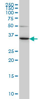 1 - LZTFL1 Antibody (monoclonal) (M01) AT2756a