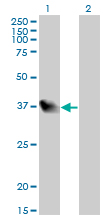 1 - LZTFL1 Antibody (monoclonal) (M01) AT2756a