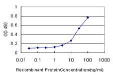 10 - MACF1 Antibody (monoclonal) (M01) AT2757a