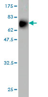 1 - MCM7 Antibody (monoclonal) (M01) AT2821a