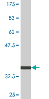 1 - MDFI Antibody (monoclonal) (M07) AT2824a