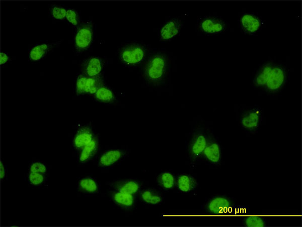 3 - MED31 Antibody (monoclonal) (M01) AT2831a