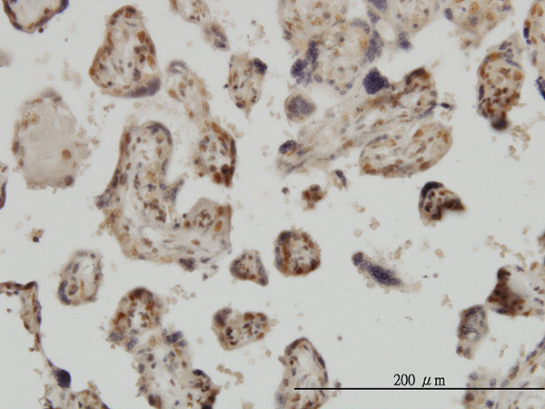 2 - MED31 Antibody (monoclonal) (M01) AT2831a