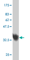 1 - MED31 Antibody (monoclonal) (M01) AT2831a
