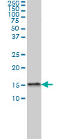 1 - MED31 Antibody (monoclonal) (M01) AT2831a