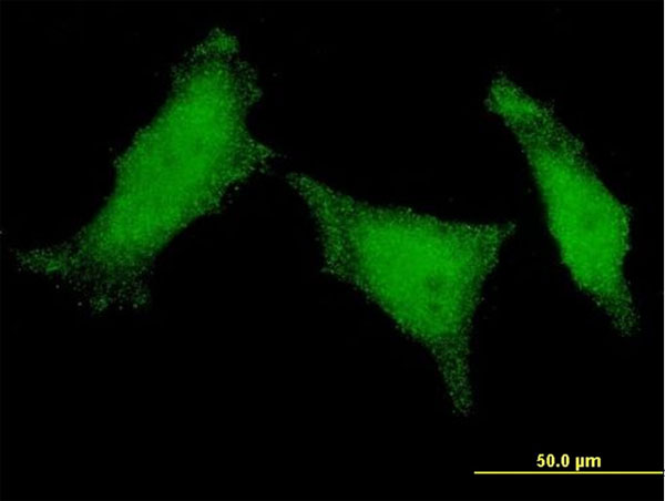 3 - MED8 Antibody (monoclonal) (M01) AT2833a