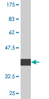 1 - MGC21874 Antibody (monoclonal) (M06) AT2861a