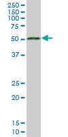 1 - MGC21874 Antibody (monoclonal) (M06) AT2861a