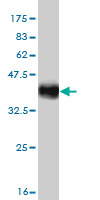 1 - MGC21874 Antibody (monoclonal) (M08) AT2862a
